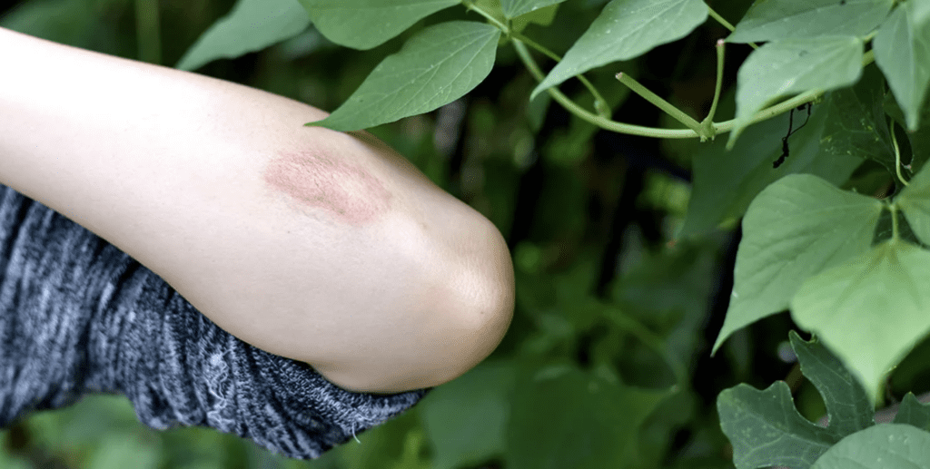 hazardous plants and plant safety