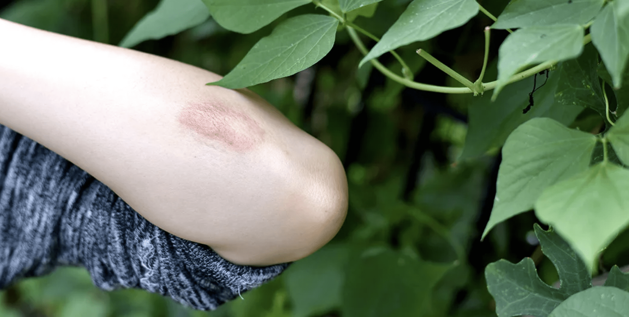 hazardous plants and plant safety